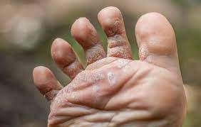 qa 335-lujain qa-g-335 أخبار  طبي أخبار في دولة قطر  #561 - 1  صورة 