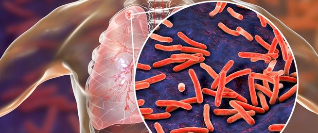 qa 335-lujain qa-g-335 أخبار  طبي أخبار في دولة قطر  #615 - 1  صورة 