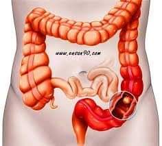 qa 335-lujain qa-g-335 أخبار  طبي أخبار في دولة قطر  #711 - 1  صورة 